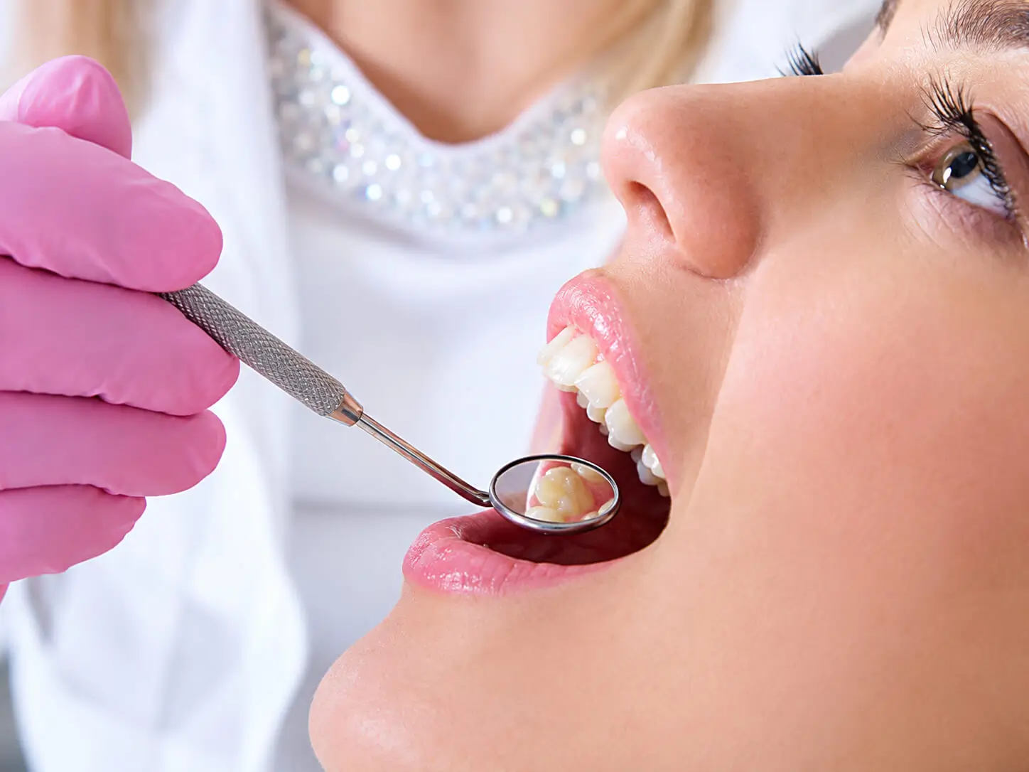 Dental Fillings at Commack Dental Associates