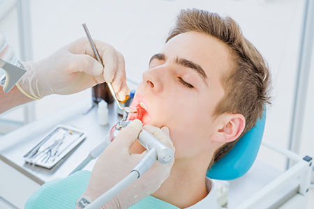 A tooth-coloured dental filling