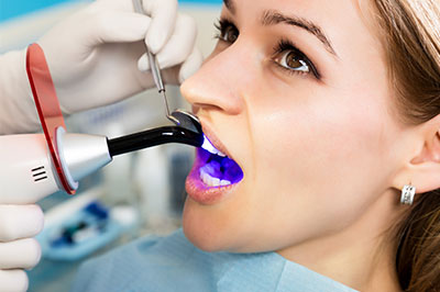 Woman receiving dental treatment with blue light device, likely for teeth whitening, in dentist s office