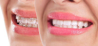 A close-up of a person s smiling face with pink lipstick, emphasizing their teeth, which are also pink