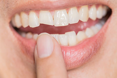 A close-up of a person s smiling mouth with teeth, holding a finger near their teeth