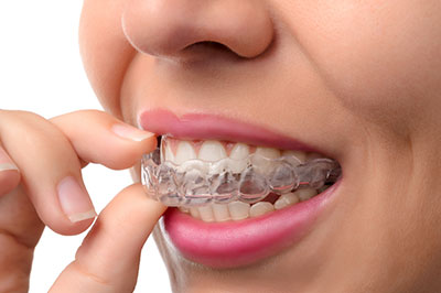 An adult female with a broad smile is holding a toothbrush close to her mouth, showing off a set of white braces