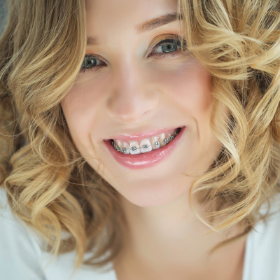 A woman with straight teeth smiling at the camera