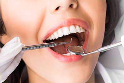 A woman with her mouth wide open, revealing teeth cleaning instruments being used by a dental professional, who appears to be a dentist