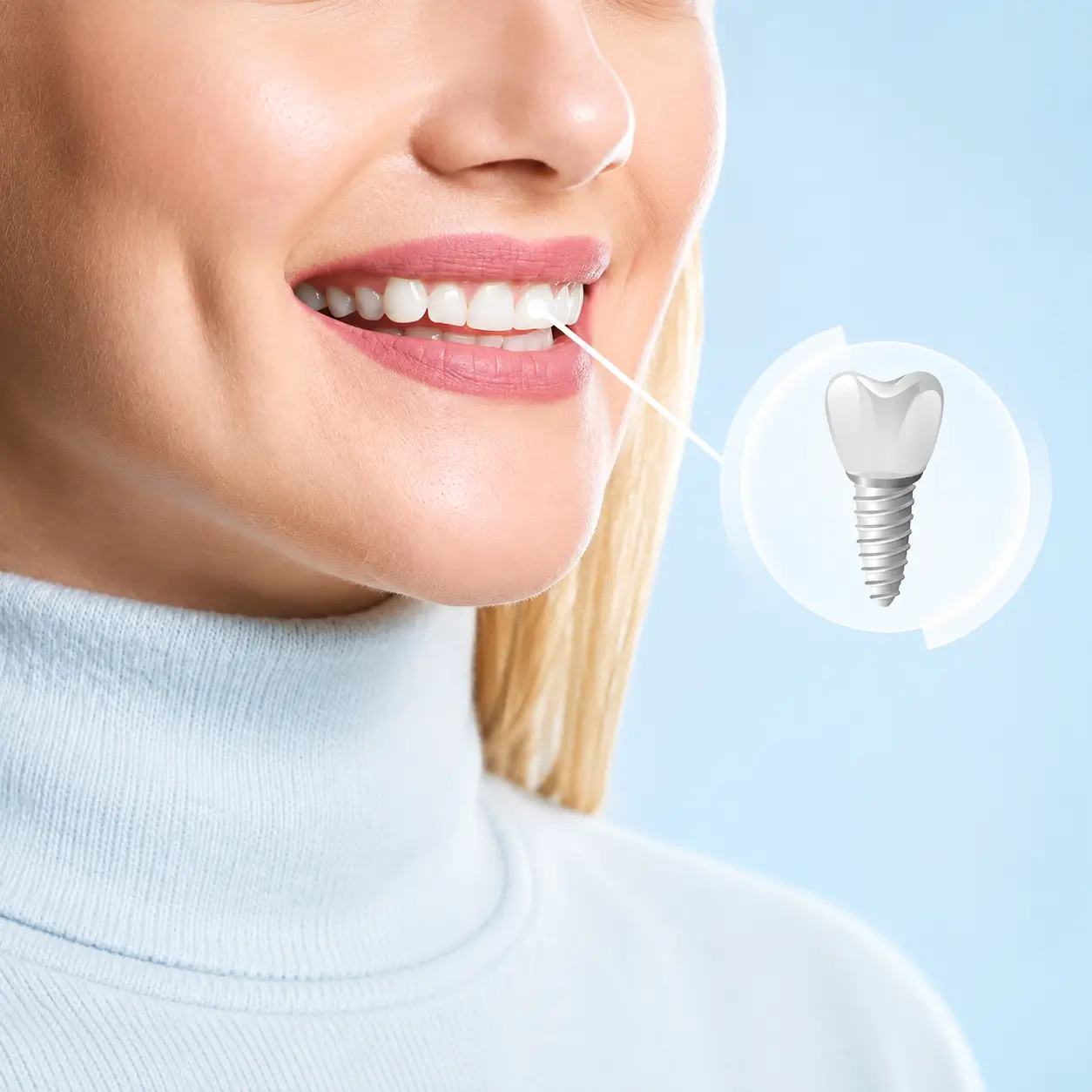A patient smiling after dental implant treatment