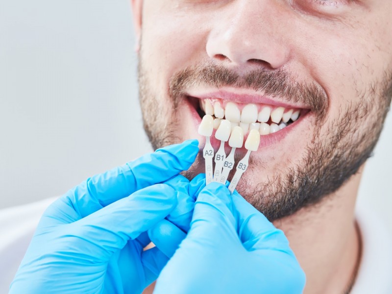 What Does Your Smile Say About You?
