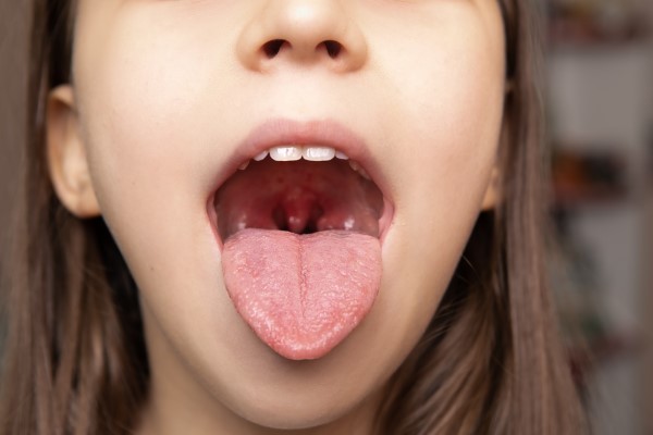 Take Care of Your Tongue