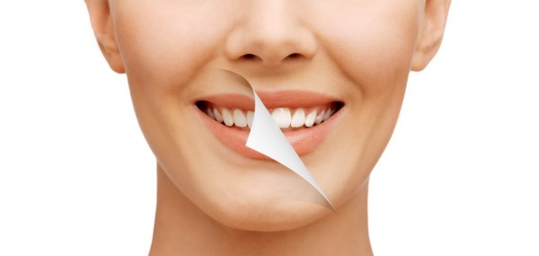 Professional Teeth Whitening Can Work Wonders For Your Smile